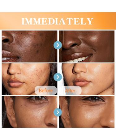 Turmeric Anti Aging Moisturizing Body Lotion Natural Turmeric Brightening Lotion for Spots Acne & Dry Skin Vitamin C Body Cream to Hydrate & Smooth Skin - Buy Online on GoSupps.com