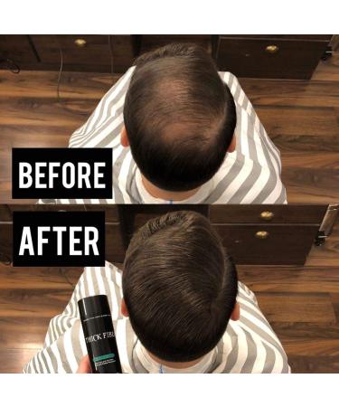 THICK FIBER Hair Fibers for Thinning Hair & Bald Spots - Dark Brown 25g Bottle - Conceals Hair Loss in Seconds - Hair Powder for Women & Men 0.88oz - Buy Online on GoSupps.com