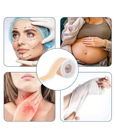 Medical Grade Silicone Scar Sheets - 1.6 x 60 inches - C-Section, Keloids, Tummy Tuck - Reduce Scarring and Promote Healing - Buy Online on GoSupps.com