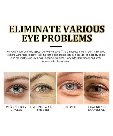 Golden Collagen Eye Care - Anti-Fine Line Treatment Moisturizing & Strengthening 60ml - Black One Size - 1 Pack - Buy Online on GoSupps.com