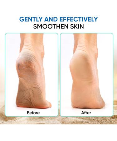 Vega Brosse pieds 4 en 1 la couleur peut varier Brosse de p dicure pour les pieds - Buy Online on GoSupps.com