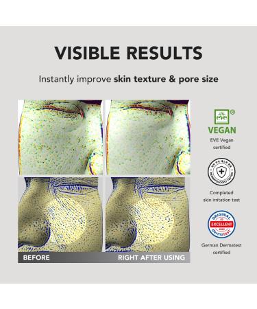 Buy SKIN&LAB Niacinamide Recovery Serum - Minimize Pores Improve Skin Texture Daily Facial Essence for Sensitive Skin | 1.01 fl.oz | International Shipping Available - Buy Online on GoSupps.com