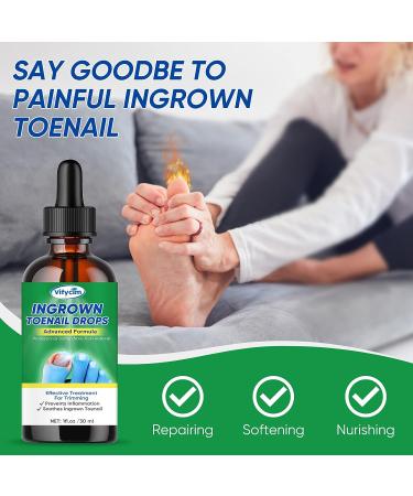 Ingrown Toenail Treatment Drops - Fast Acting Pain Relief & Softener 30ml - Buy Online on GoSupps.com