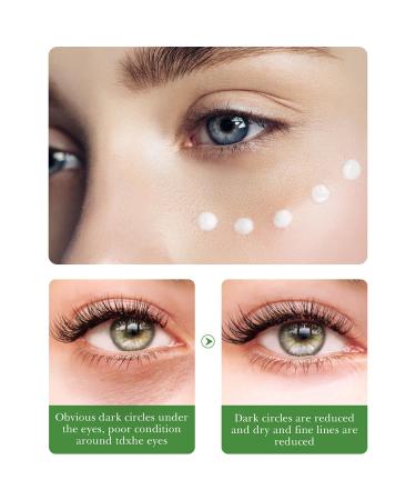 Buy BIOAQUA Centella Asiatica Eye Cream - Nourish Repair Soothing Oil Control Anti-Acne | 20g/0.7oz - International Shipping Available - Buy Online on GoSupps.com