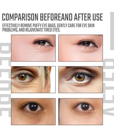 Caffeine Solution 5% + EGCG Eye Serum Caffeine Eye Serum Under Eye Cream for Dark Circles and Puffy Eyes Under Eye Serum Caffeine Eye Cream for Eye Bags Remover Dark Circles under Eye Treatment Women 1 - Buy Online on GoSupps.com