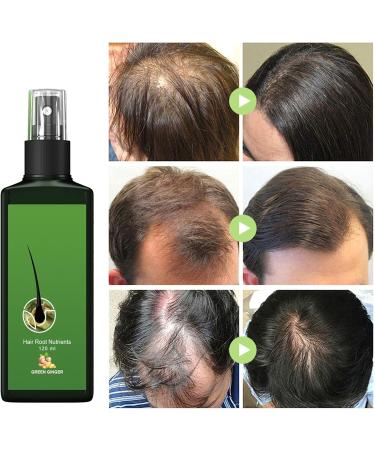 120ml Regrowth Nourishing Ginger Spray Serum Pousse Cheveux Spray Nourrissant Au Gingembre S rum de Croissance Capillaire au Gingembre pour le Traitement de la chute des Cheveux - Buy Online on GoSupps.com