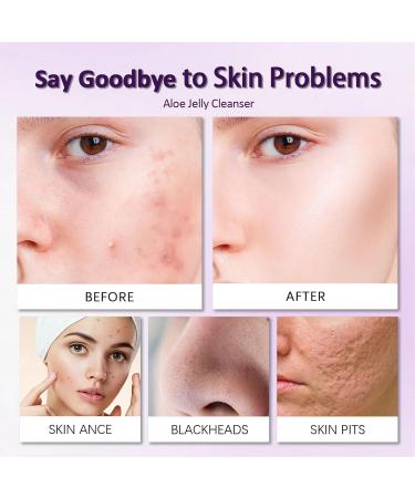 Aloe Vera Face Wash Face Cleanser for Sensitive Skin - Hydrating Cleanser with Hyaluronic Acid & Glycerol Blemish Control Cleanser for Oily Skin Face Wash for Acne Prone Skin and Acne Treatment - Buy Online on GoSupps.com