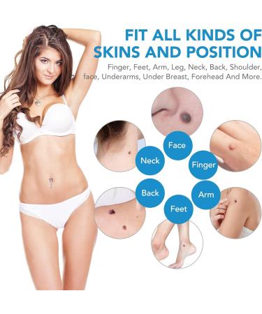 Skin Tag Remover Kit for Face & Body - Fast & Easy Removal Pen for 2mm-8mm Tags, Safe & Painless with 40 Bands & 10 Wipes - Buy Online on GoSupps.com