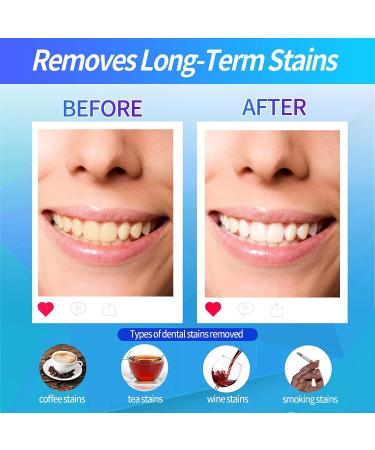 Professional White Stripes Teeth Whitening Strips - 14 Pack (28 Strips) for Effective Stain Removal & Mint Freshness - Buy Online on GoSupps.com