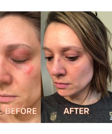 FATCO Organic Myrrhaculous Anti-Aging Face Cream with Tallow & Myrrh - Lavender + Myrrh (1 oz) | Natural Moisturizer for Youthful Skin - Buy Online on GoSupps.com