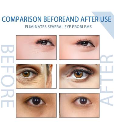 Seurico Peptide Depuffing Eye Serum & Gel | Lift Firm & Reduce Dark Circles - Anti-Wrinkle Eye Cream (5PCs) - Buy Online on GoSupps.com