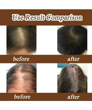 wimony Batana Oil Organic Batana Oil For Hair Growth 100% Pure Raw Natural Batana Oil for Healthy Hair Batana Oil Hair Treatment Promotes Hair Growth Smoother and Shinier Thicker Improve Hair Loss(1PC - Buy Online on GoSupps.com