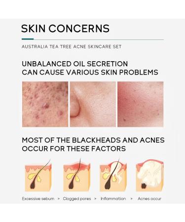 Tea Tree Skin Care Set for Teen Girls | 5PCS Skincare Gift Set with Cleanser Toner Serum & Acne Gel Moisturizing Travel Essentials - Buy Online on GoSupps.com