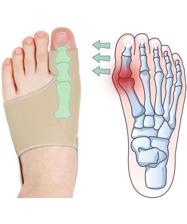 Bunion Corrector for Women & Men Bunion Socks Toe Corrector Comfortable & Breathable for Day/Night Support Hallux Valgus Pain Relief Non-Slip Big Toe Straightener beige