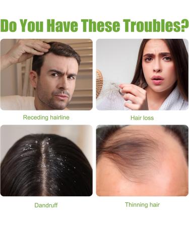 Rosemary Hair Oil(60ml) Rosemary Oil for Hair Growth Diluted Rosemary Essential Oils for Hair Loss & Skin Care Strengthens Hair Nourishes Scalp Hair Loss Improve Oil for Women and Men - Buy Online on GoSupps.com