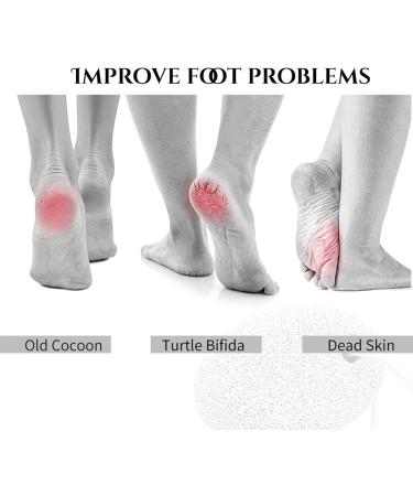 Pumice Stone Lava Pedicure Tools Hard Skin Callus Remover Callus Hard Dead Skin Remover Effective Exfoliation Gentle Pumice Stone Pedicure Tool - Buy Online on GoSupps.com