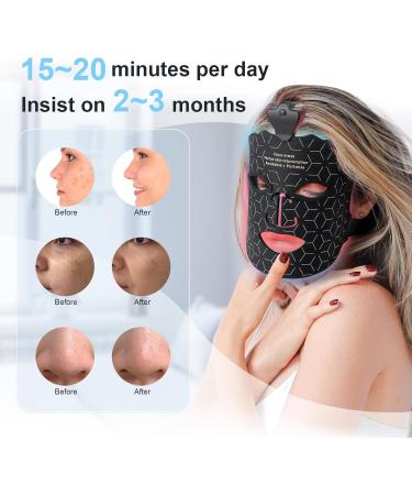  foreverLily LED Light Therapy Mask for Face and Neck - 7 Colourful LEDs - Beauty Device for Skin Rejuvenation and Firming Anti-Aging Wrinkles and Spots (Black) - Buy Online on GoSupps.com