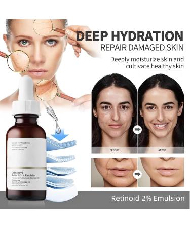 Face Moisturiser Retinoid 2% Emulsion Retinol Serum High Strength for Face Retinol Face Serum Anti Wrinkle Serum Fade Fine Lines Acne Reduced Skin Repair Serum for Women & Men 30ml 1PC Retinoid 2% Emulsion - Buy Online on GoSupps.com
