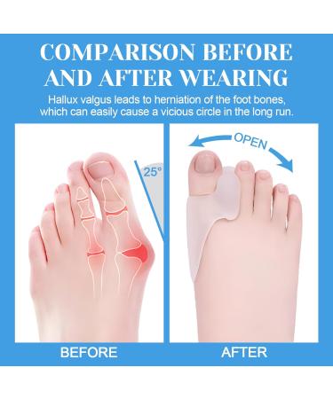 Pack of 6 Reusable Bunion Cushion Protectors - Gel Shields & Toe Spacers for Foot Pain Relief | Comfortable Bunion Pads for Yoga & Daily Use - Buy Online on GoSupps.com