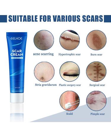 Best Scar Cream for All Types | Scar Angel - Effective Silicone Ointment for Stretch Marks & Post-Op Care - Buy Online on GoSupps.com
