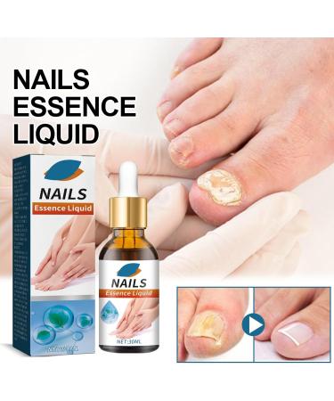 Nail Fungal Treatment Nails Essence Liquid Toenail Treatment Extra Strong Nail Repair Fingernail Toenail Care Fix Renew Damaged Broken Anti Fungus Nail Repair 30ML - Buy Online on GoSupps.com