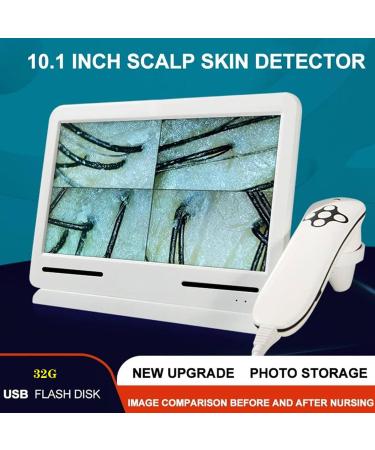 10.1-Inch Skin Scalp Hair Follicle Detector - Portable Hair Tester with 200x Probes & Photo Storage for Home Beauty Salon | International Shipping Available - Buy Online on GoSupps.com