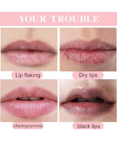 Lips Pink Bleaching Cream Balm Lip Lightening Scrub Balm Lip Lightening for Dark Lips Long Lasting Lip Care with Natural Oil Lip Care Lightens Remove Dark Lips for Women Moisturizing Lip Brightening - Buy Online on GoSupps.com