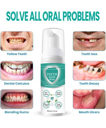 Foam Toothpaste - Deep Cleaning for Stains/Teeth Yellowing Gum Care Fresh Breath Easy to Use(1PCS) 1 Fl Oz (Pack of 1) - Buy Online on GoSupps.com