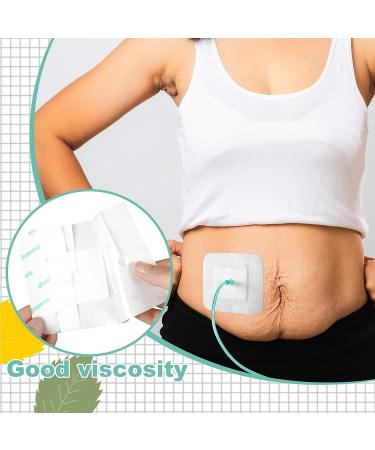 50 Pcs Feeding Tube Pads 4x4 inch - Adhesive Bandages for PD Catheter G Tubes - Dialysis Accessories and Supplies - Buy Online on GoSupps.com