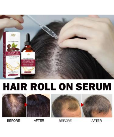  Whnbuij Hair Growth Oil - Natural Hair Oil For Women And Men Regrowth Oil For Thinning Hair | Nourishing Jojoba Oil Anti Frizz Hair Density Oil - Buy Online on GoSupps.com