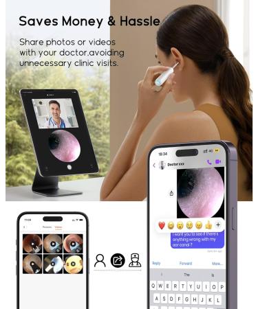 Bebird Home 30S Ear Camera System - Ear Cleaner with Flexible Otoscope UVC Light & Tweezers - Effective Ear Wax Removal Tool for Adults & Kids - Buy Online on GoSupps.com