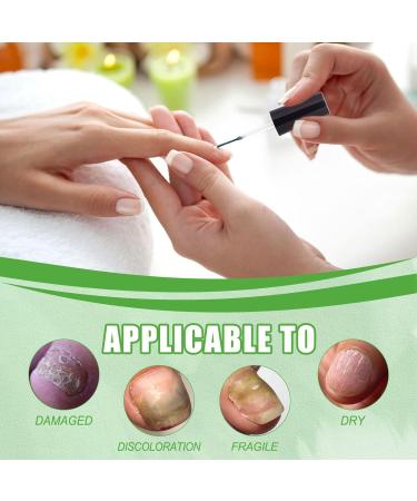 Keratin 3 Day Growth Nail Treatment & Strengthener Nail Growth Treatment for Nail Strengthener Fast Keratin Nail Hardener Nail Repair Treatment for Thin Nails Strengthening Nail Polish Nail Serum - Buy Online on GoSupps.com