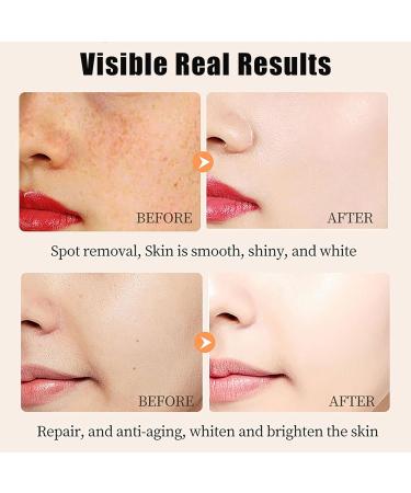 Vitamin C Serum for Face 30Capsules - Anti-Aging Vit C Face Oil - Dark Spot Correcting Glow Serum - Hydrating Facial Serum - Skin Care Serum for Uneven Skin Tone Anti-Wrinkle Reduces Fine Lines - Buy Online on GoSupps.com