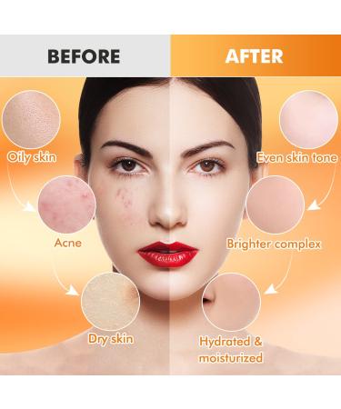 Poztl Jelly Mask Powder - Turmeric Anti-Fold Acne Gel Face Mask | Professional DIY Hydro-Facial Mask for Fine Lines & Uneven Skin Tone - 23 fl oz - Buy Online on GoSupps.com