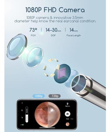 Qimic 1080P FHD Wireless Ear Wax Remover Camera | Ear Cleaner Kit with 6 LED Lights | Visual Otoscope for Adults, Kids & Pets - Black - Buy Online on GoSupps.com