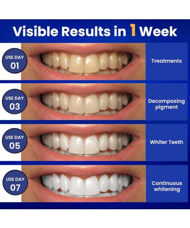 Enamel Safe Teeth Whitening Strips - Non-Sensitive 14 Pack | 28 Pcs Mint Flavor - Fast & Effective Results - Buy Online on GoSupps.com