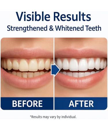 Ir-Mi-Remi-Neral-Tooth Tooth Remineral+ Tooth Gouttes de remin ralisation pour blanchir les dents Blanchiment des dents avec gouttes de remin ralisation Renforcement de l' mail - 60 ml 2Pcs - Buy Online on GoSupps.com