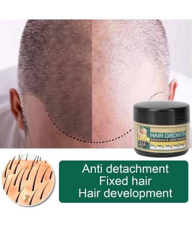 Hair Growth Cream for Men & Women - Nourishing Treatment for Healthy & Strong Hair - 1.06oz - Buy Online on GoSupps.com