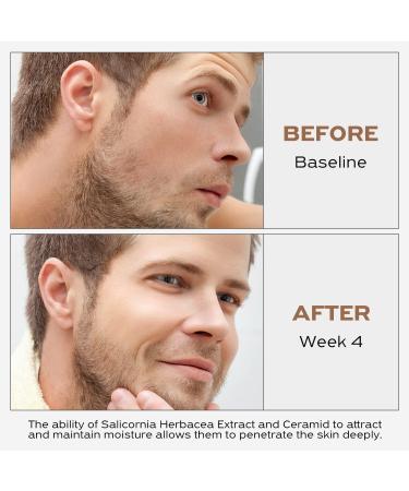 IGAME Intensive Face Moisturizing Cream | Hydrating & Fragrance-Free | 1.7 Fl. Oz | Ideal for All Skin Types | International Shipping Available - Buy Online on GoSupps.com