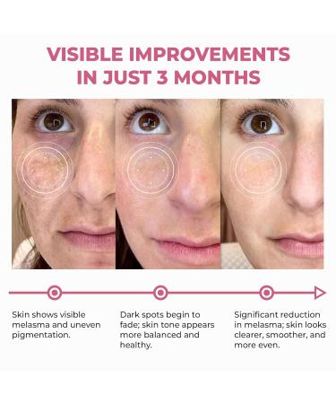 Abera Skin Renewing Serum For Anti-Wrinkle Melasma Treatment Anti-Aging For Face High Potency Saffron Extract Lavandula Stoechas Extract Hydrating Serum 1.01 Fl Oz - Buy Online on GoSupps.com