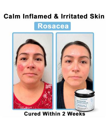 Magnesium Skin Repair Cream 2025 New Skin Treatment Cream Effectively improves skin texture and reduces blemishes (1PC) - Buy Online on GoSupps.com