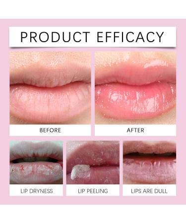 homomdy ProCollagen Peptide Lip Gloss Balm Vitamin E Lip Care Nourishing and Moisturizing Reduces Fine Lines Improves Dryness Softer and Smoother Repairs Cracked Lips 3pcs - Buy Online on GoSupps.com