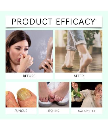 VKaoess Tea Tree Oil Foot Spray Natural Refreshing Spray for Shoes and Feet Deodorant Deodorant for Smelly Feet Foot Care with Aloe Vera for Men and Women 5 Bottles - Buy Online on GoSupps.com