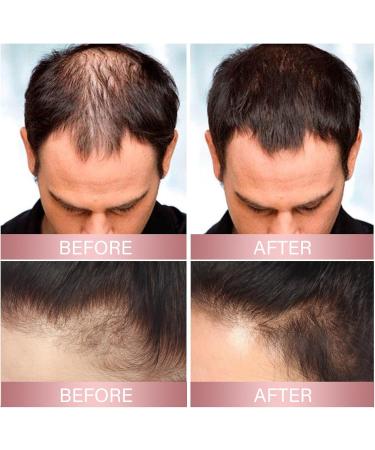 Rice water shampoo 200 ml rice water shampoo cleansing hair nourishes frizz dry hair hair shine care shampoo shampoo - Buy Online on GoSupps.com