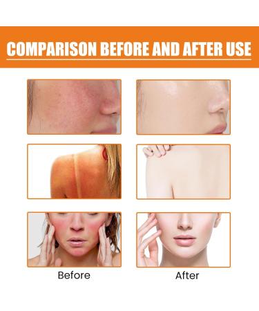 Face Sunscreen SPF 50 SPF 50 Moisturizer Lightweight under Makeup Travel Essentials Summer Essentials Skin Care Sunscreen for Face & Body 2025 - Buy Online on GoSupps.com