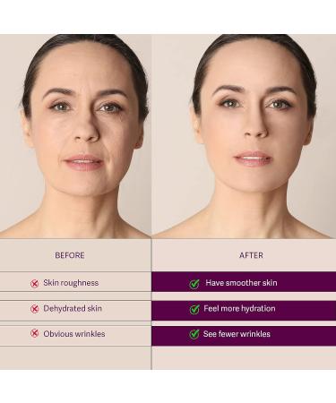Anti Wrinkle Patches 192 Pcs - Reduce Fine Lines, Frown & Smile Lines - Facial & Forehead Wrinkle Patches for Women & Men - Overnight Face Treatment - Buy Online on GoSupps.com