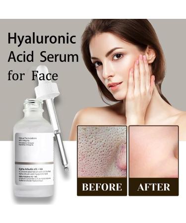 Hyaluronic Acid Serum for Hydrated Hyaluronic Acid For Face Hydrated Hyaluronic Acid Serum for Face Lightweight Face Serum Plump and Smooth Skin for All Skin Types Skin Care - Buy Online on GoSupps.com