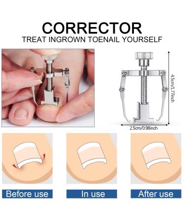 15 Pieces Stainless Steel Ingrown Toenail Tools Set - Nail Clipper Cuticle Cutters Pedicure Kit for Thick Nails (Black) - International Shipping - Buy Online on GoSupps.com