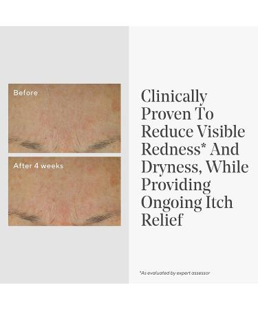 Murad Eczema Control Bundle: Daily Defense & Quick Relief Colloidal Oatmeal Creams - Buy Online on GoSupps.com
