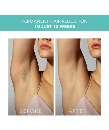 FOREO Peach 2 IPL Hair Removal Device - Full Body & Face Hair Remover - Permanent Results - Skin Cooling Technology - Mint - Buy Online on GoSupps.com
